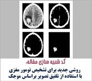 مقاله پیاده سازی شده با متلب : تشخیص تومورهای مغزی با استفاده از موجک