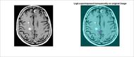 کد متلب تشخیص تومور مغزی در تصویر MRI